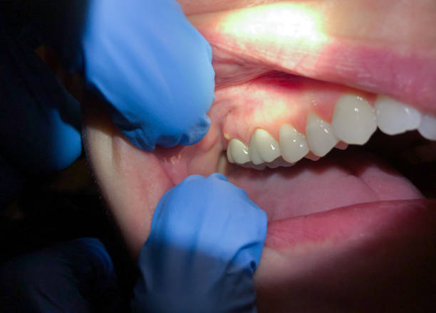 Best Tooth Pain Emergency Relief  in Bourbon, IN