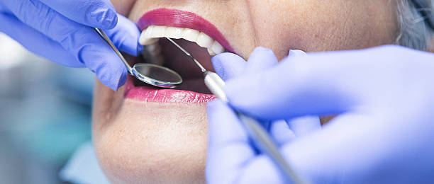 Best Teeth Whitening  in Bourbon, IN